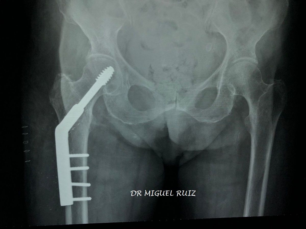 Miguel Angel Ruiz Resendiz-3