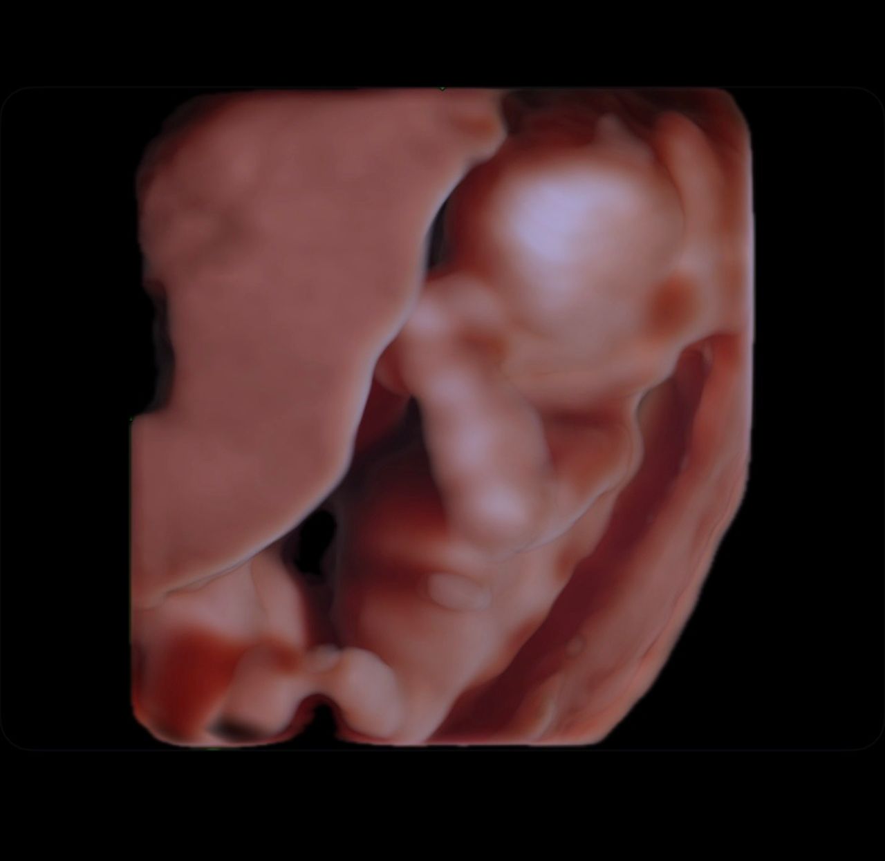 Jacquelin Montserrat Gadea Noriega-1