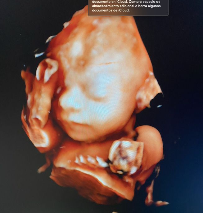 Andrés Murillo Mendoza-3