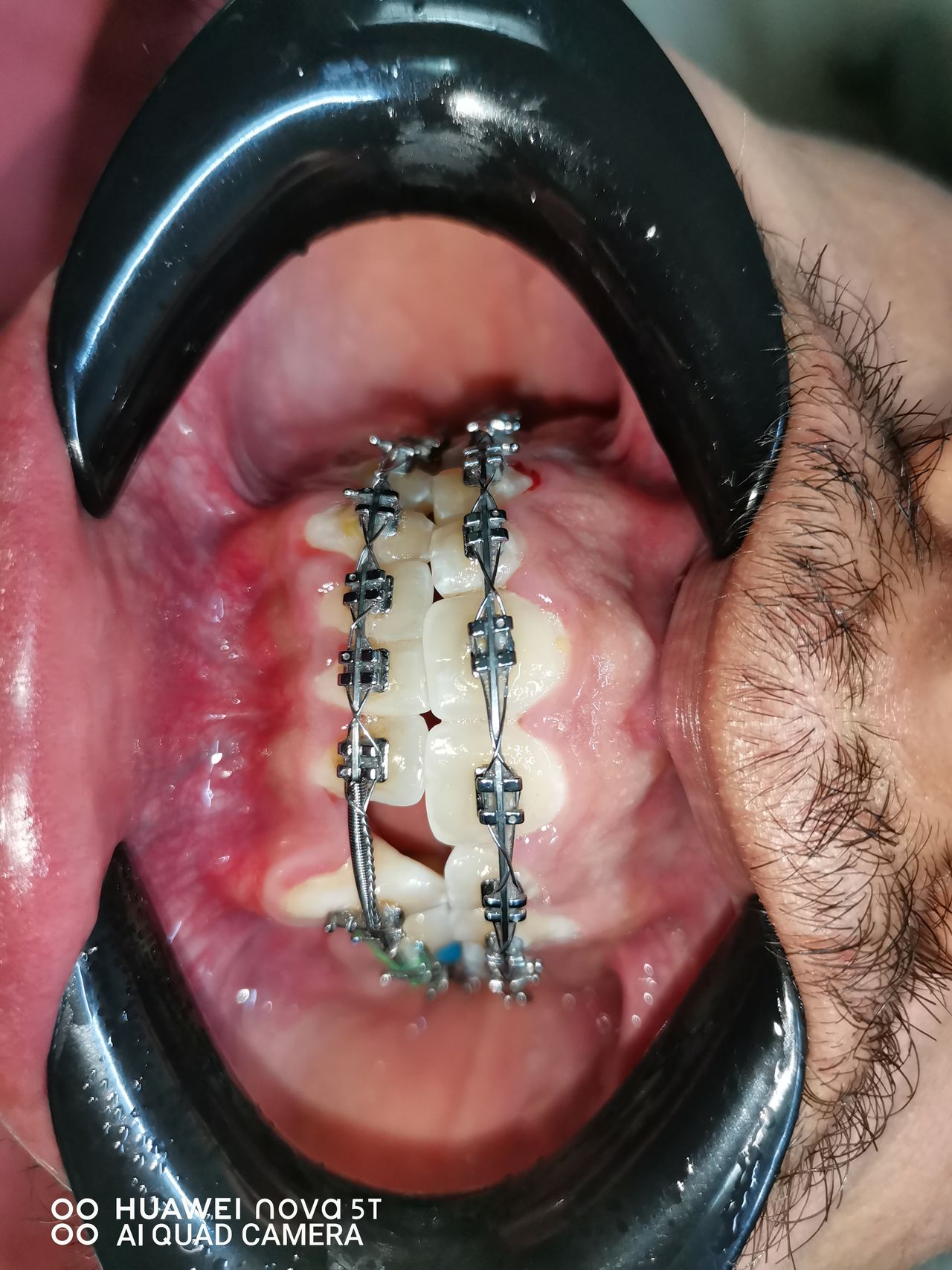 Emma Selenia Hernández Castillo-13