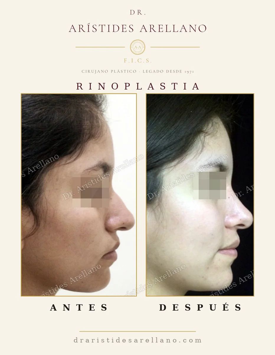 Arístides Arellano Huacuja-39