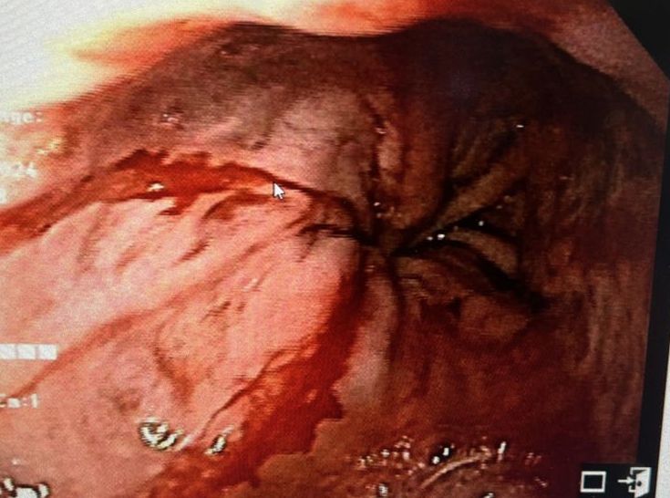 Yuridia Macías Ángeles-5