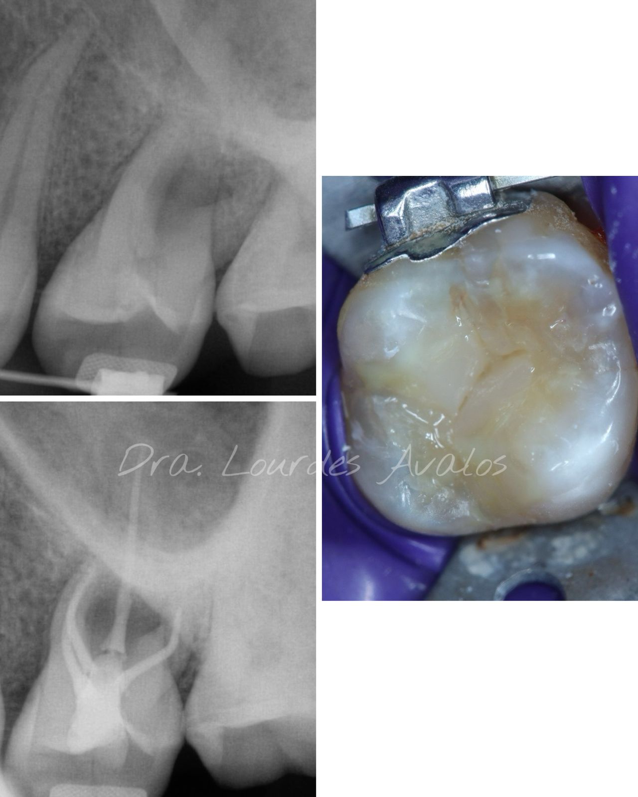 Lourdes Avalos Piña-0