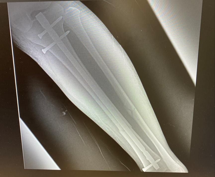 Jeftte Aaron Chacon Martinez-18