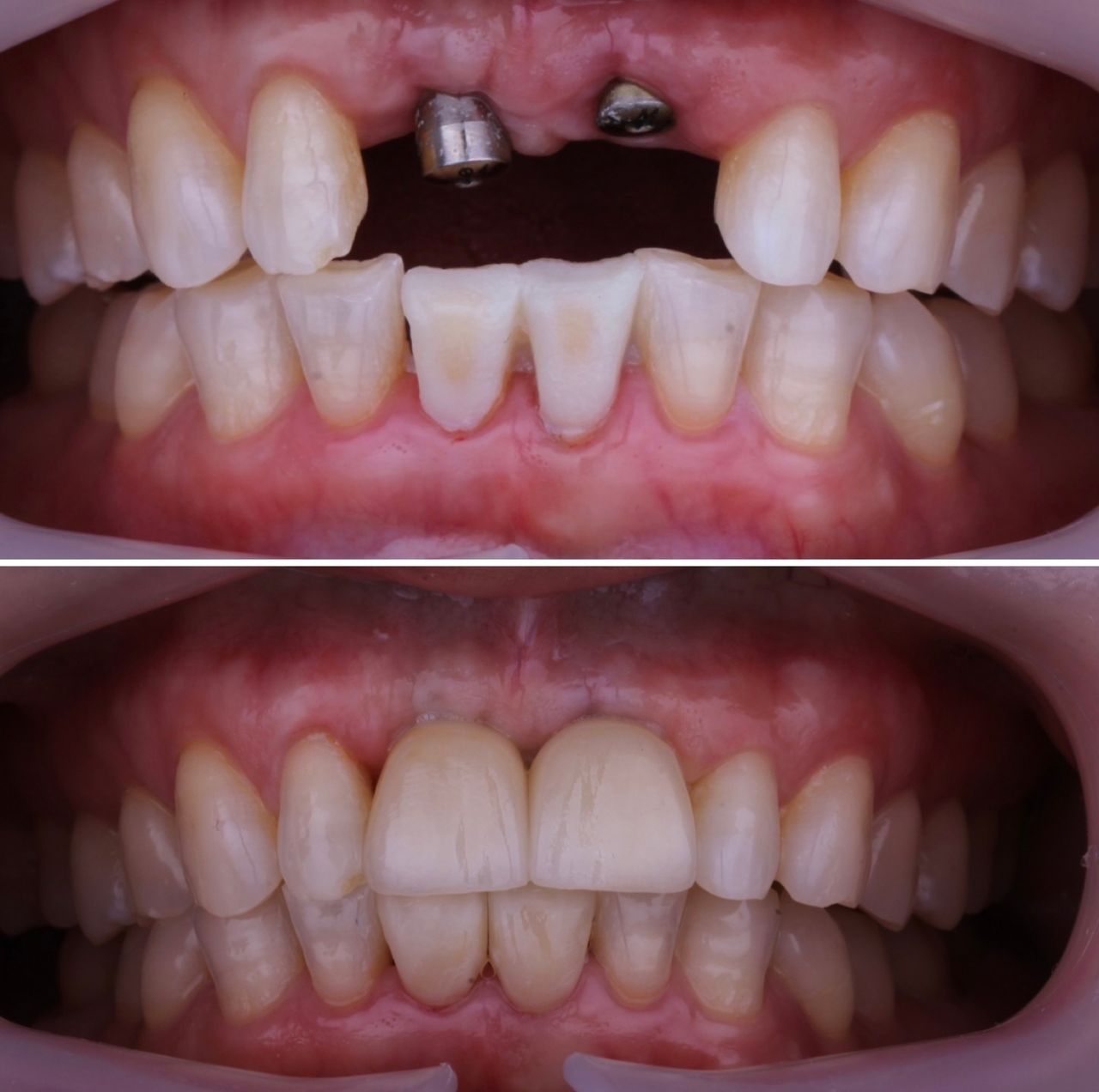 Josué Márquez Gómez-60