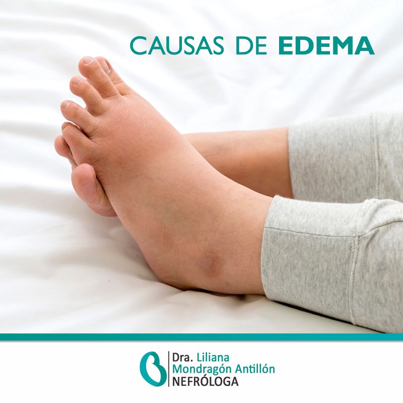 Liliana Mondragón Antillón-17