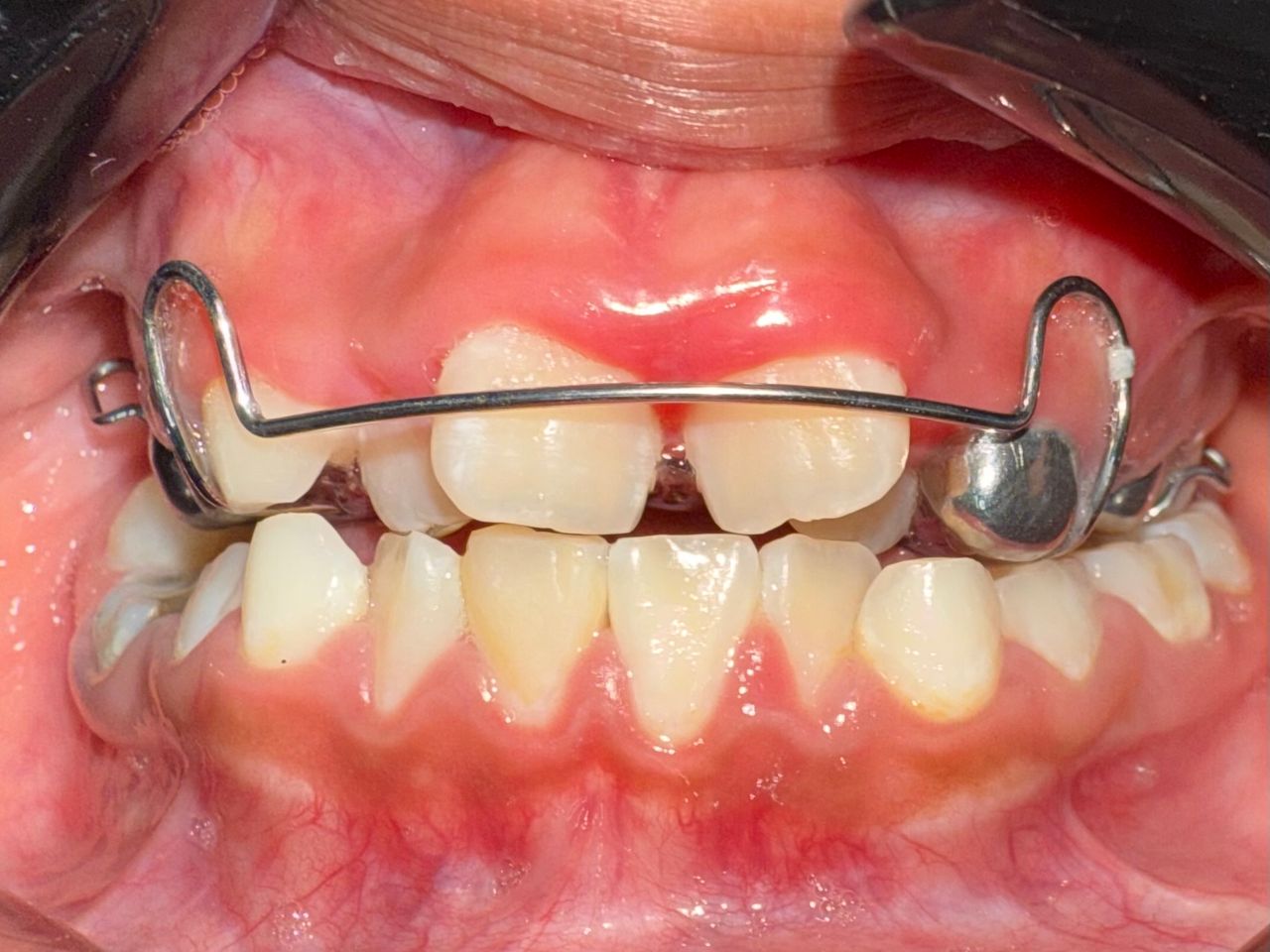 Jair Contreras García-60