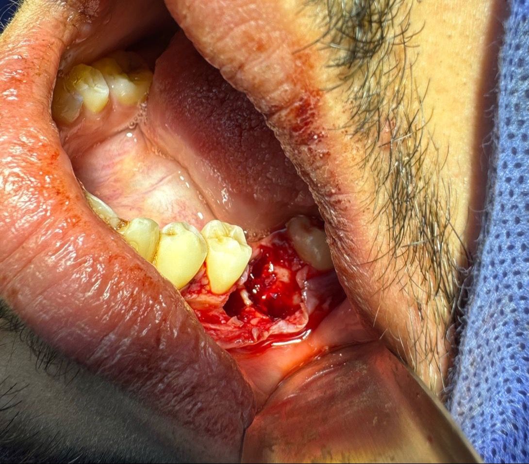 Luis Angel Carranza Resendez-6