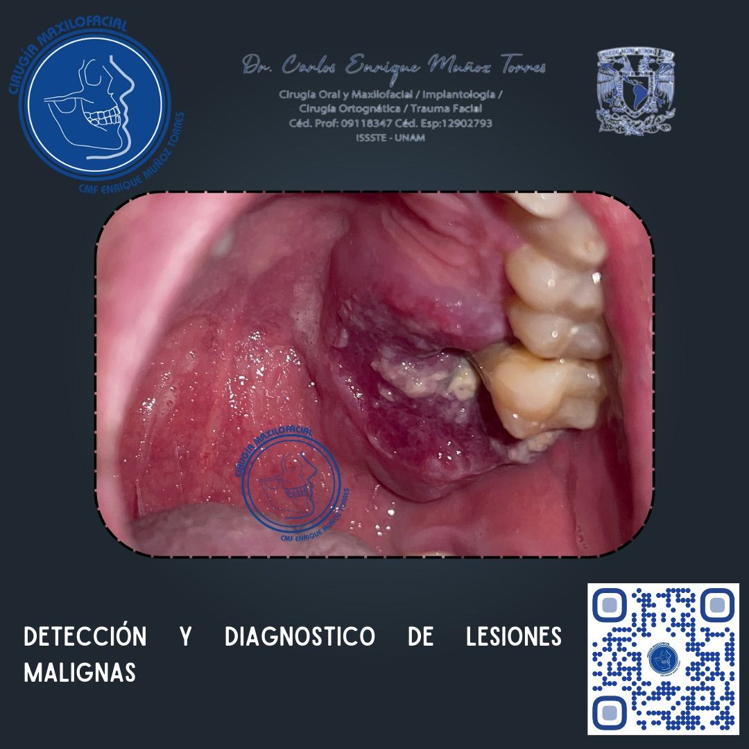 Carlos Enrique Muñoz Torres-11