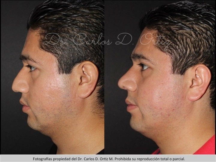 Carlos David Ortiz Moreno-48