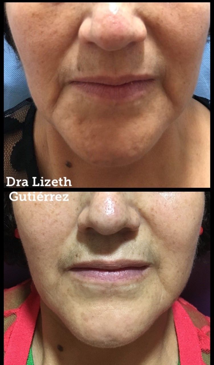 Lizeth Alejandra Gutiérrez Chavéz-15