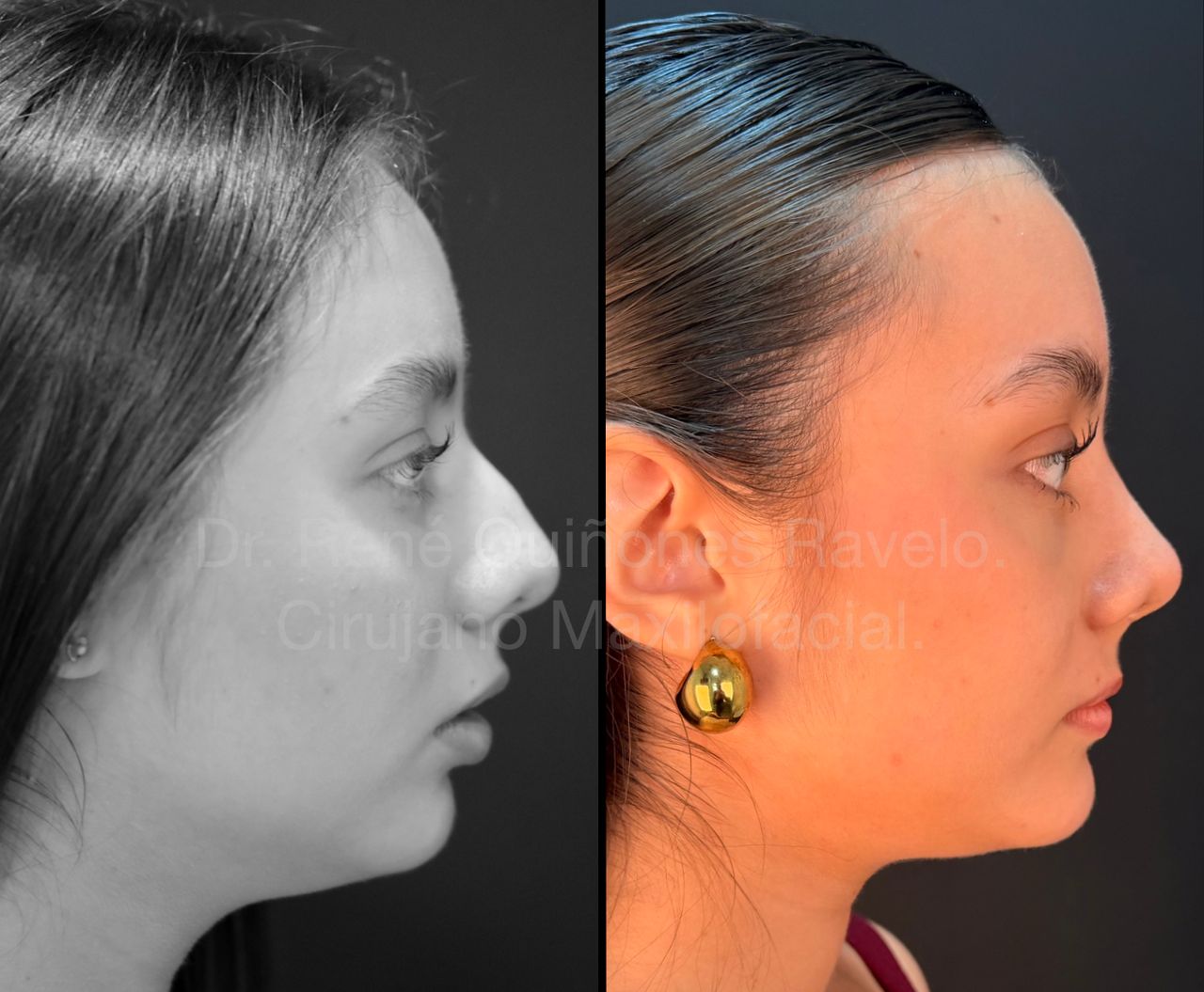 René Quiñones  Ravelo-7