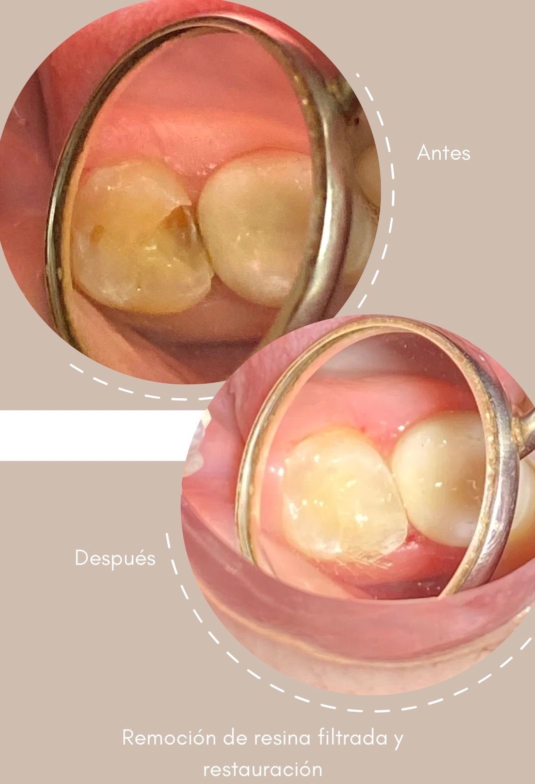 Valeria Garza Noyola-5