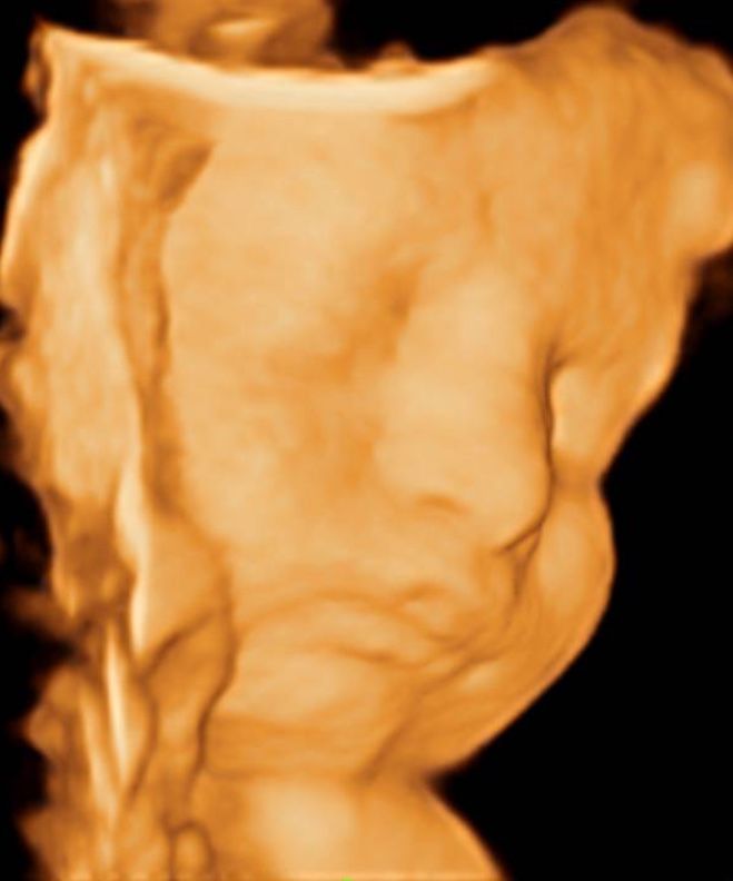 Luis Fernando Alvarez Valenzuela-1