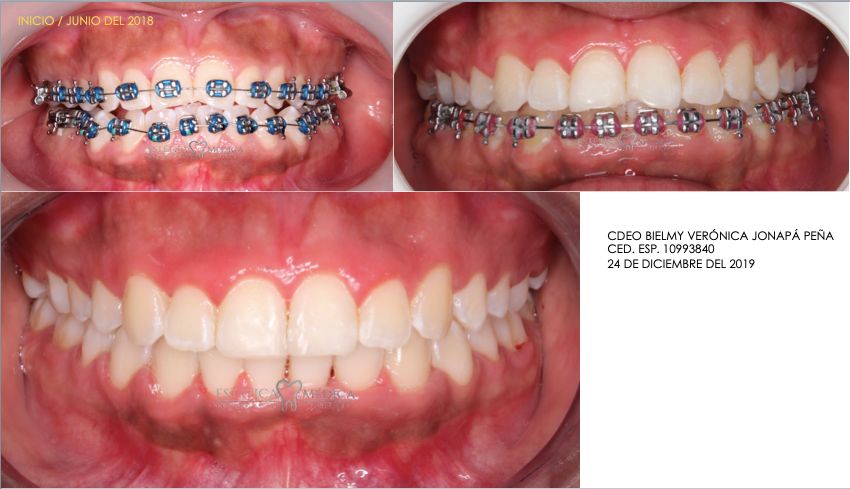 Bielmy Veronica Jonapa Peña-27