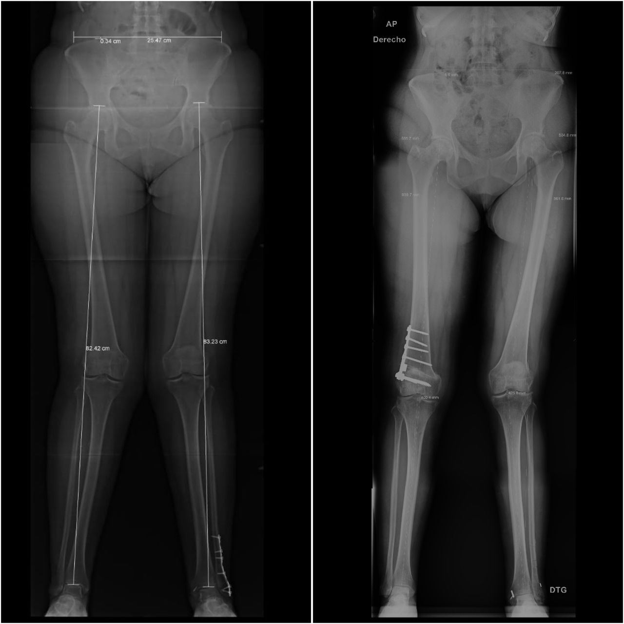 Jorge Manuel Valadez Soto-12