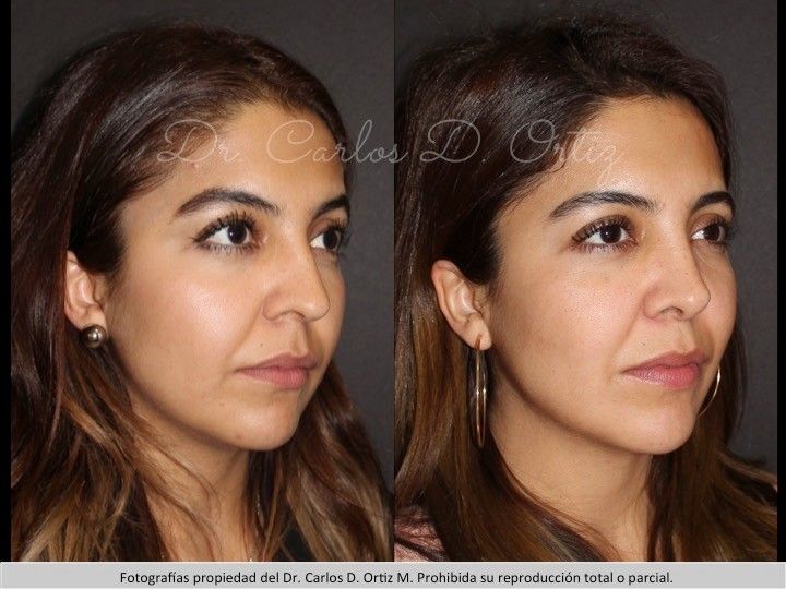 Carlos David Ortiz Moreno-55