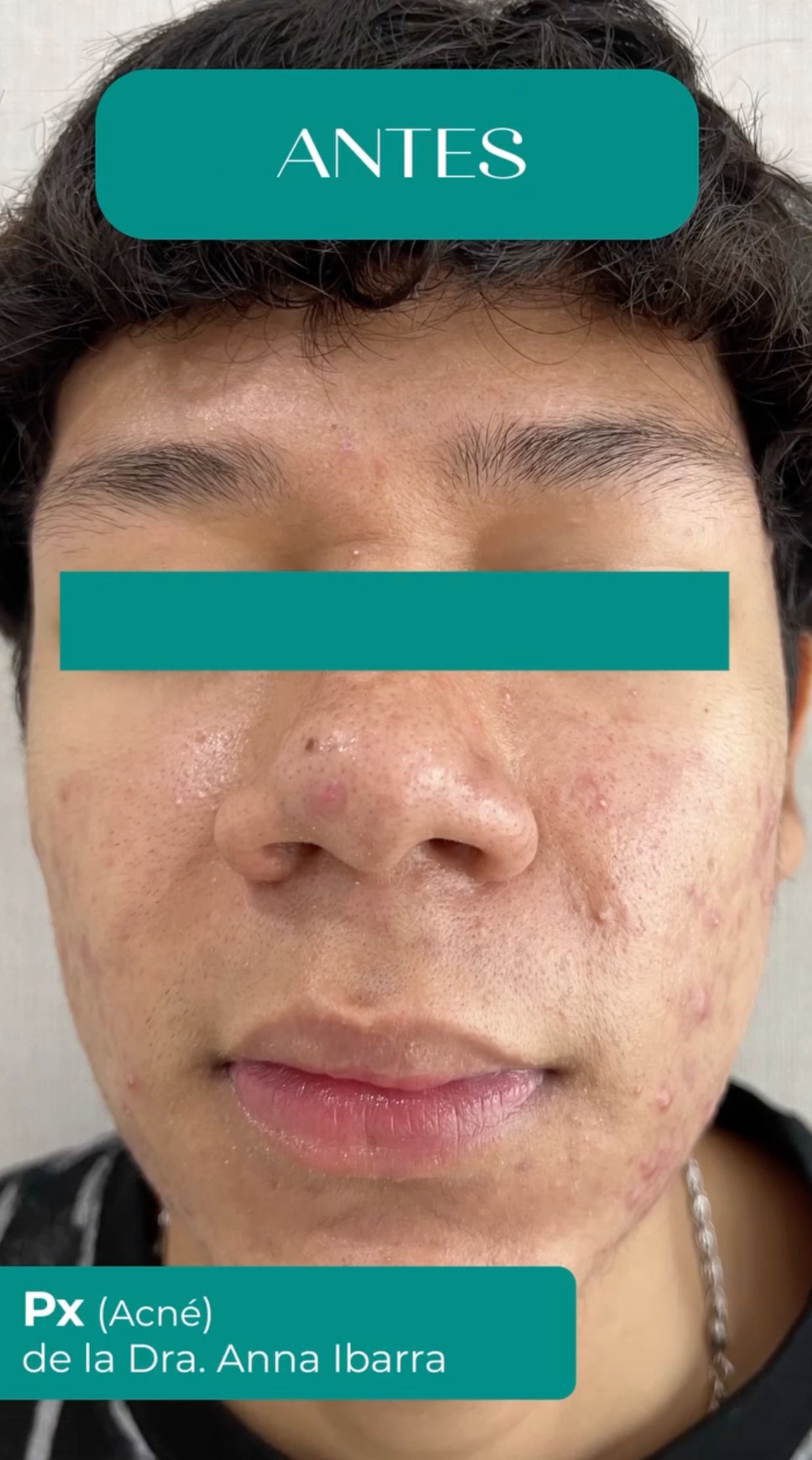 Anna Luisa Ibarra Puentes-15