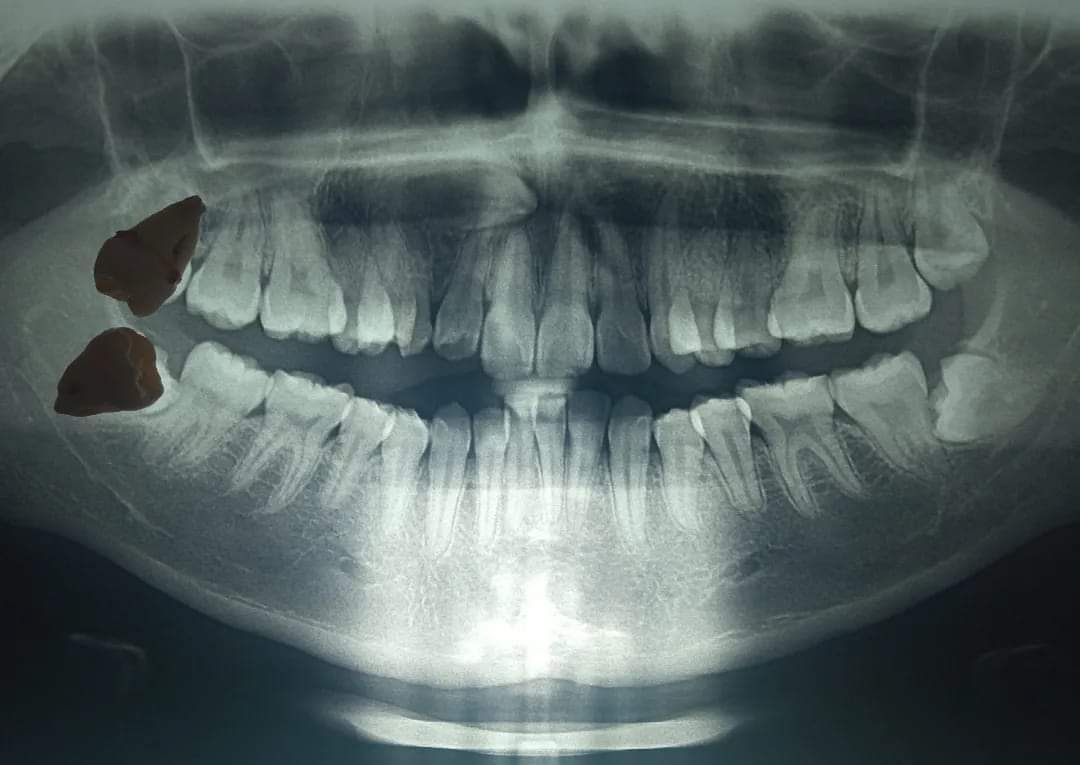 Jacqueline Nuñez Herrera-11