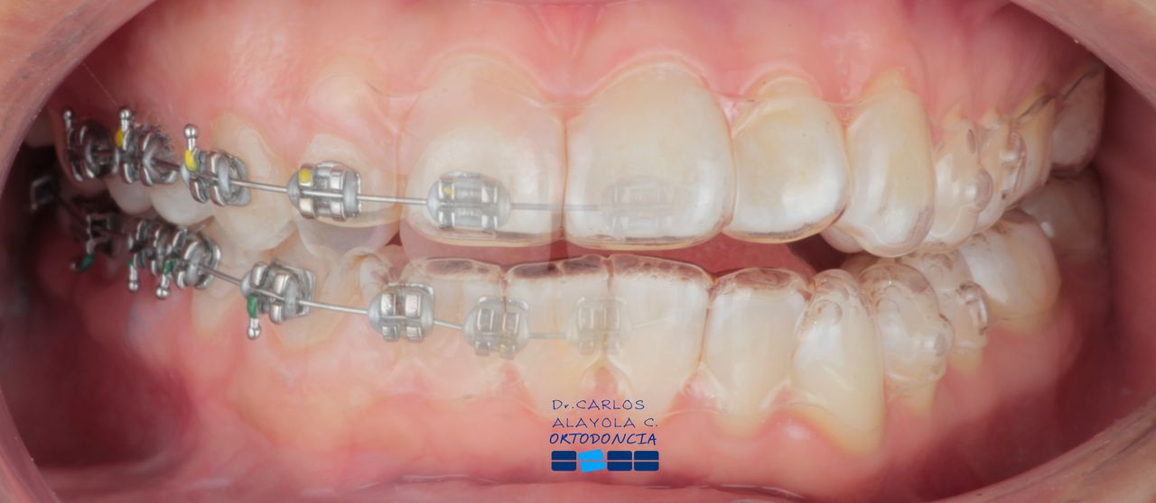 Carlos Humberto Alayola Cáceres-1