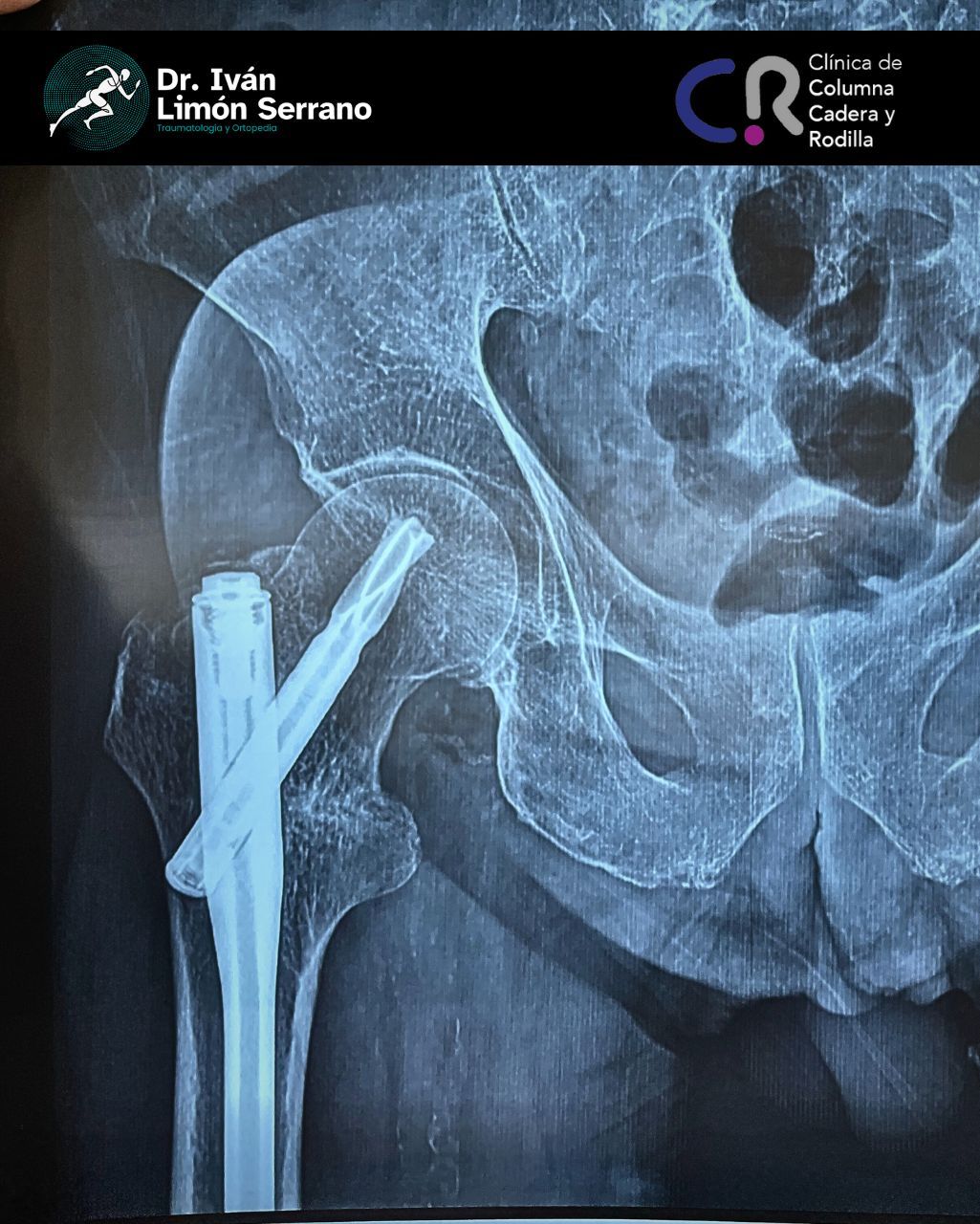 Iván Limón Serrano-38