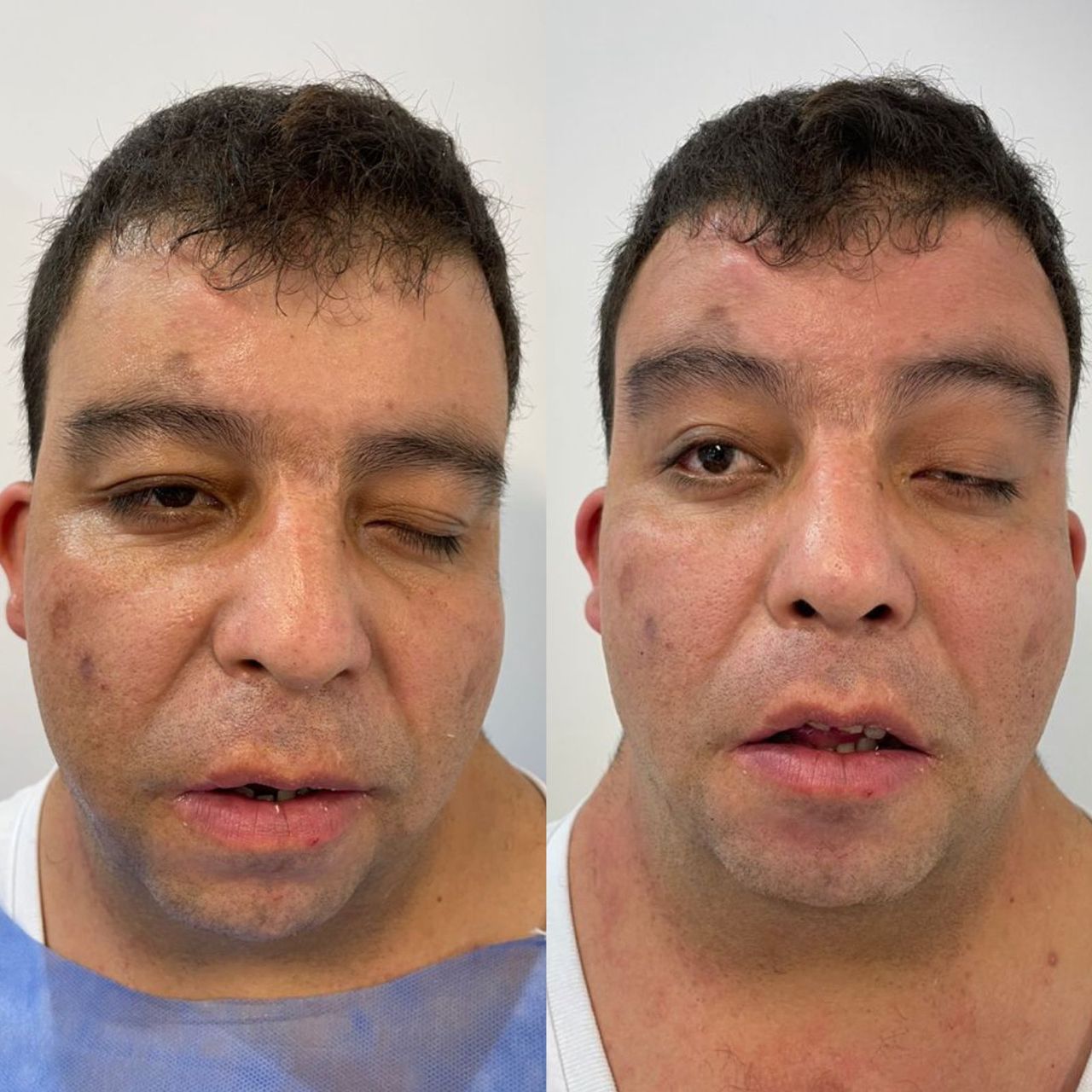 Juan Herrera Hernández-25