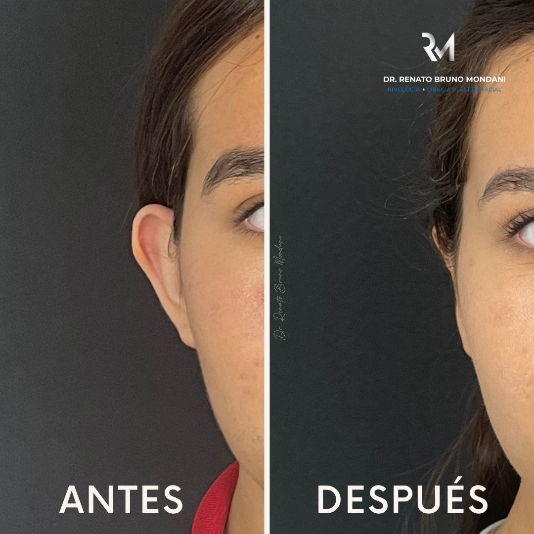 Renato Bruno Mondani-2