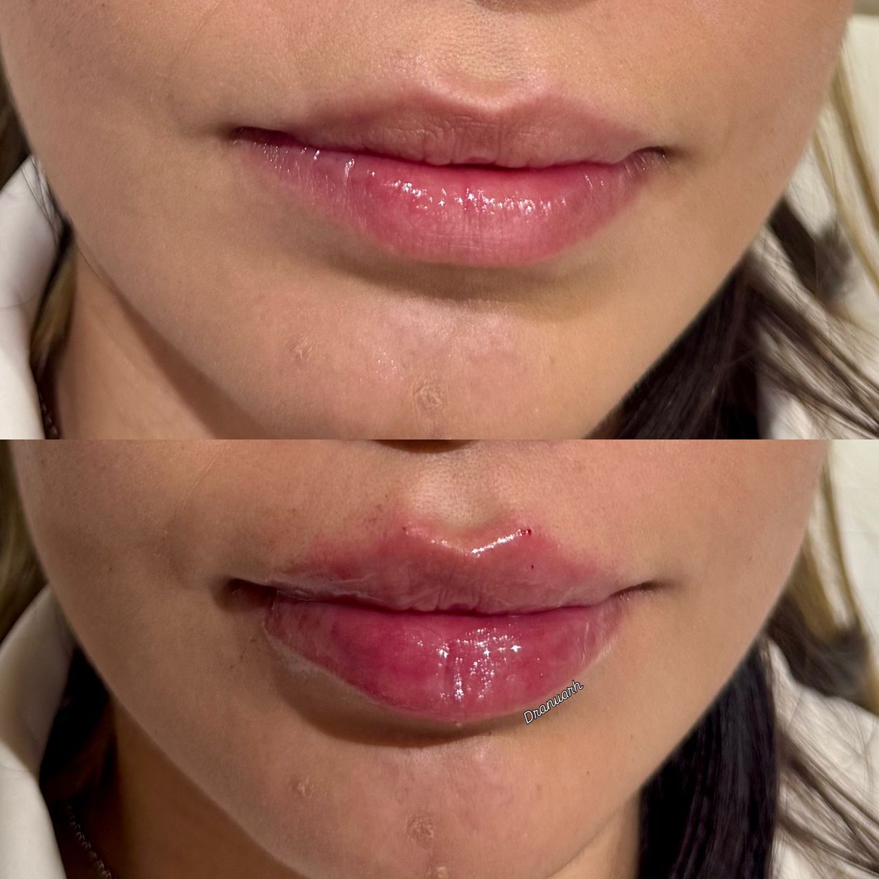 Anuar Hernández Flores-18