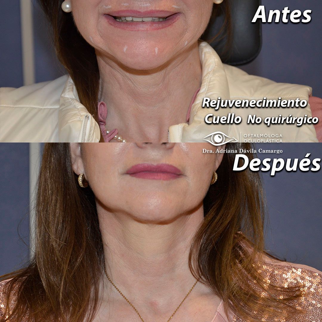 Adriana Davila Camargo-10