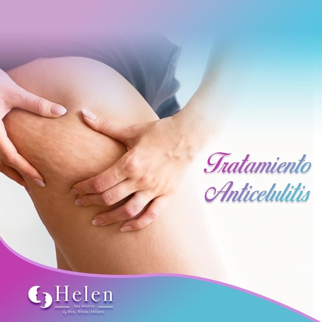 Elena Alvarez Velazquez-56