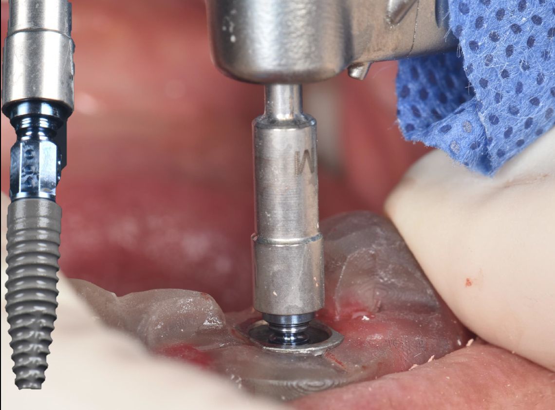 Berenice Ontiveros-7