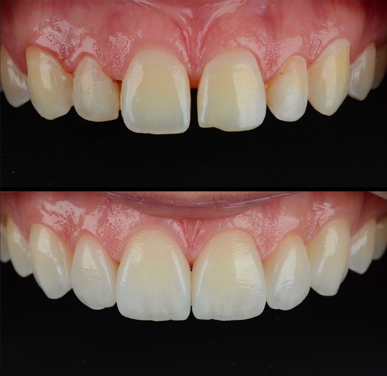 Angel Gabriel Hernández Sánchez-5