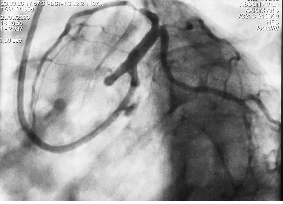Abdón Ávila Chávez-13