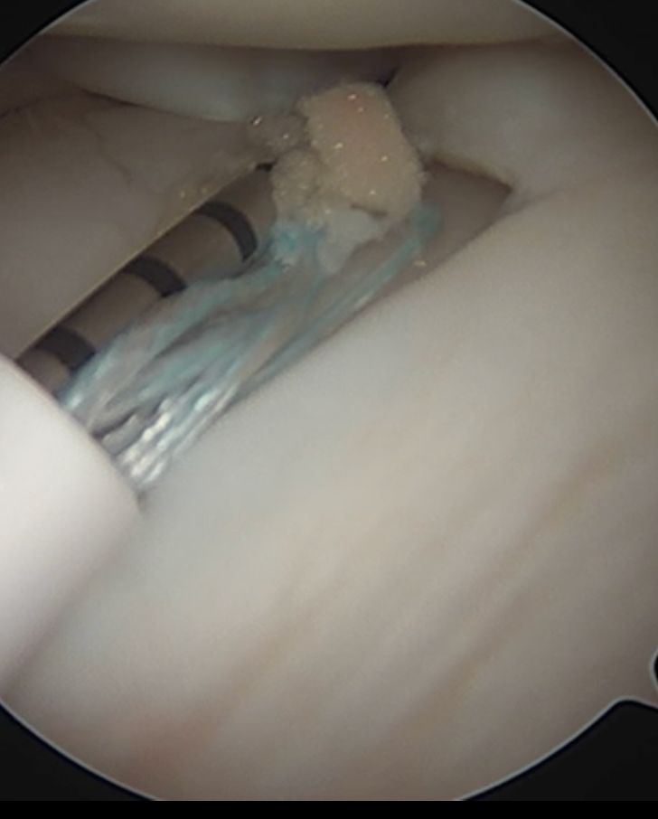 Carlos Ignacio Muñoz Valadez-37