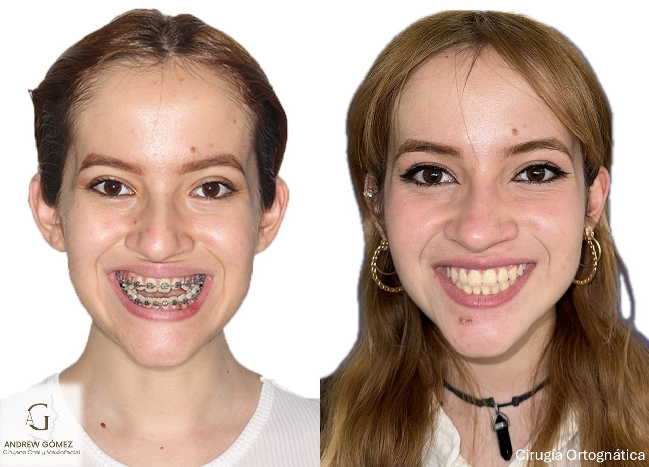 Kevin Andrew Gómez Hernández-14