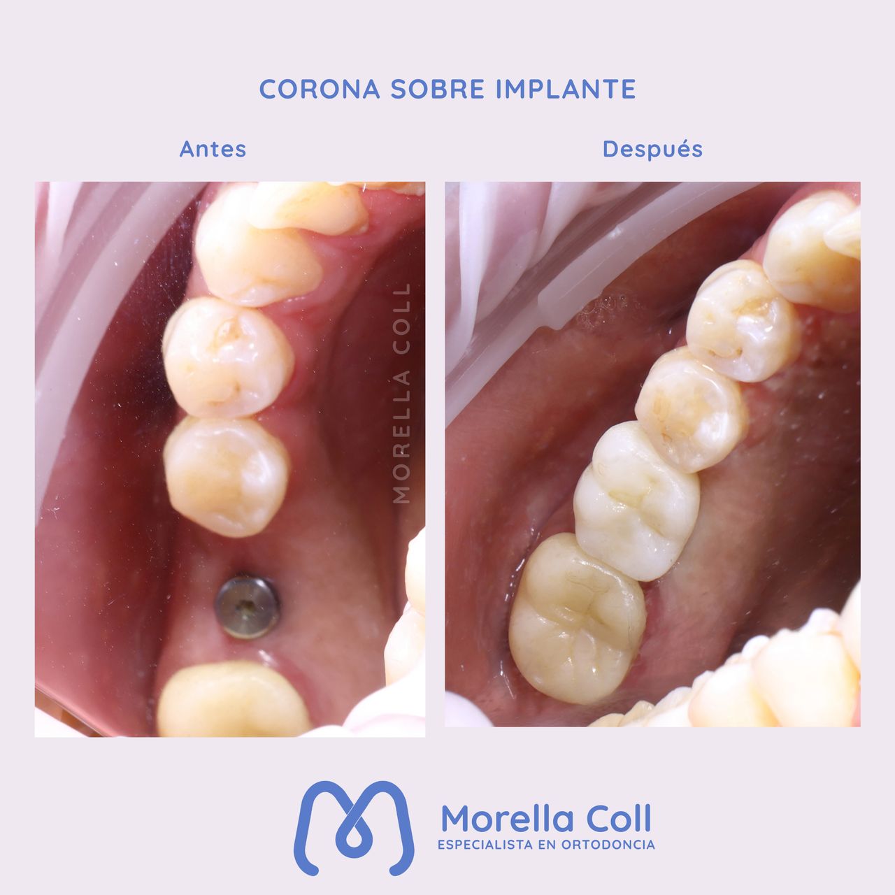 Morella Coll Mibelli-15