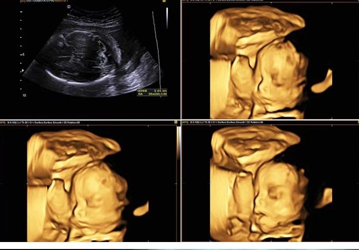 Jorge Augusto Gamboa Balam-5