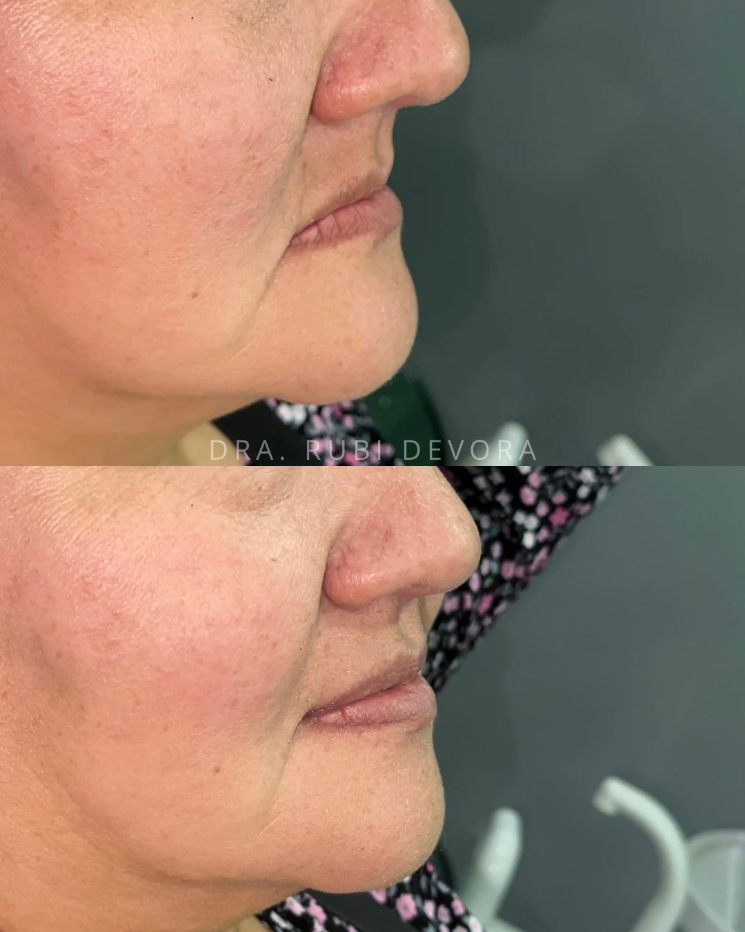 C Rubi Devora Figueroa-15