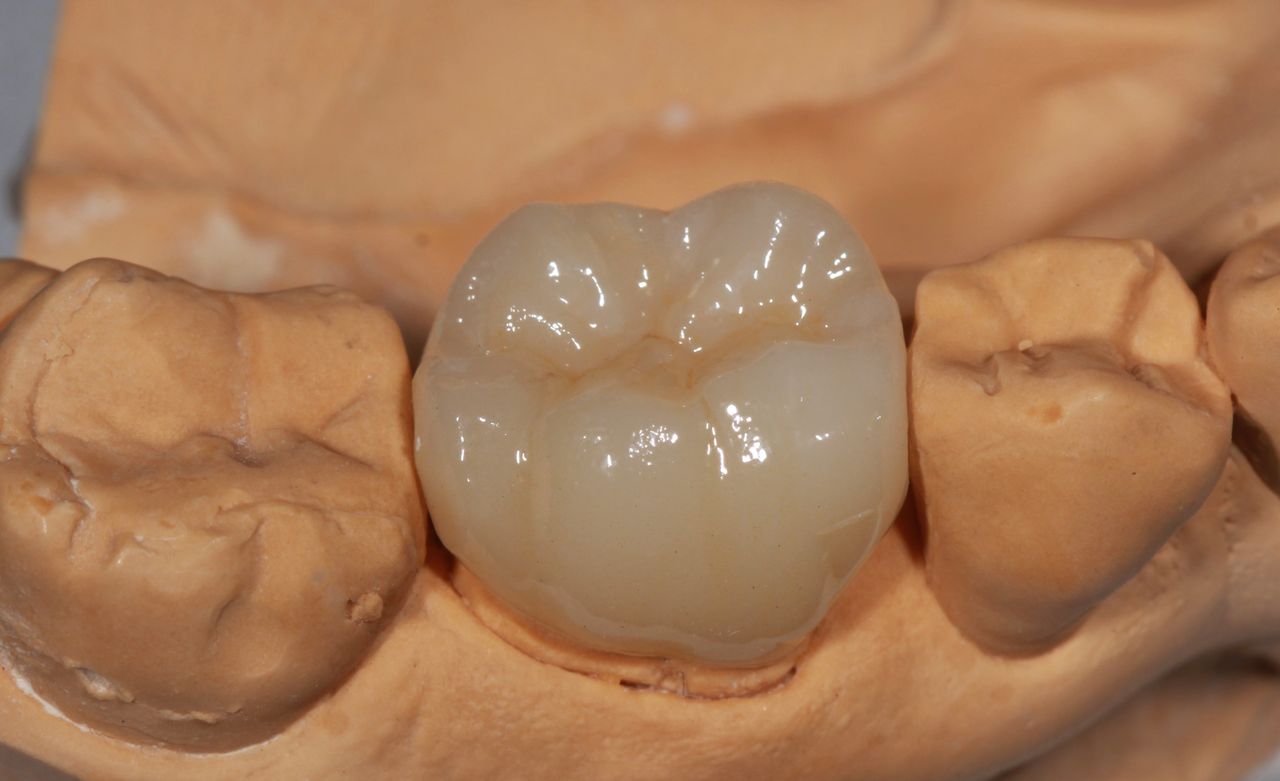 Jesus De La Cruz Ballinas-34