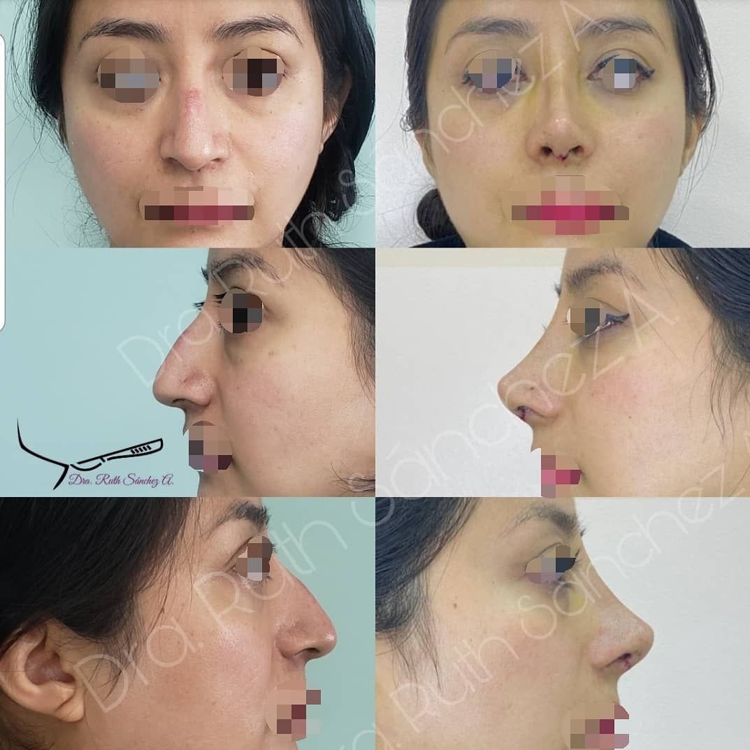 Ruth Sánchez Alvarez-5