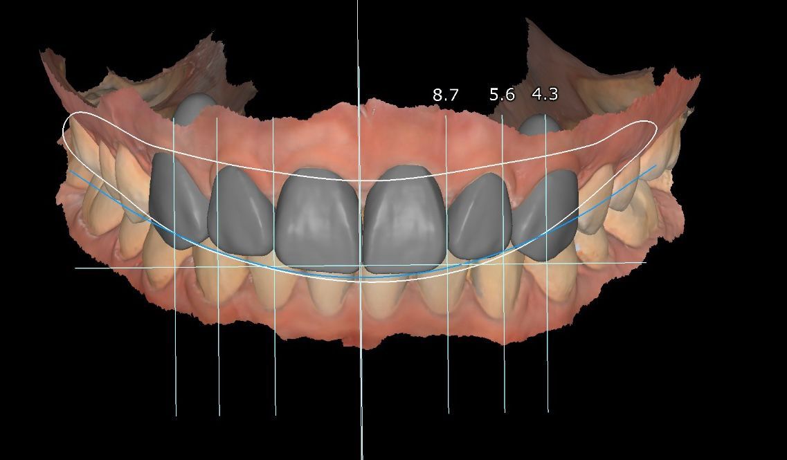 Fredy Alejandro Roblero Gónzalez-33