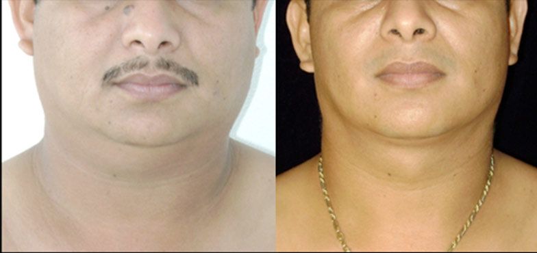 Edgar Ernesto Torres Mejía-12