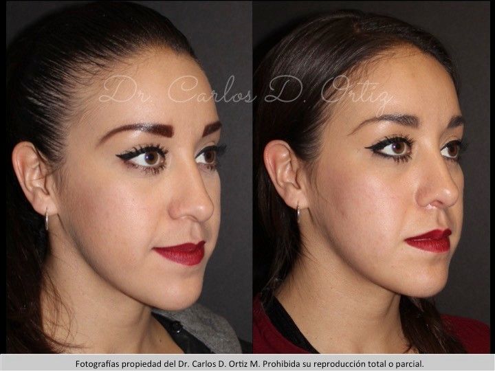 Carlos David Ortiz Moreno-46