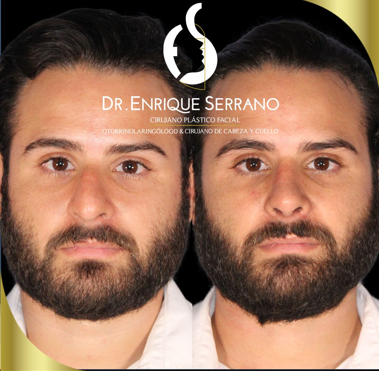 Enrique Serrano Cruz-2