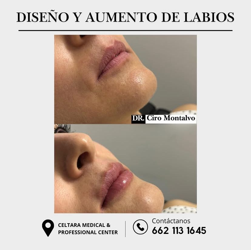 Ciro Alberto Montalvo Bojorquez-6