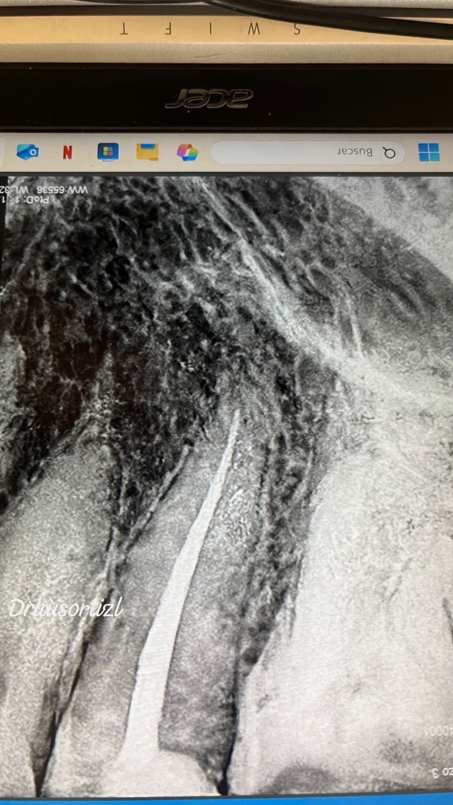 Luis Ángel Ortiz López-31