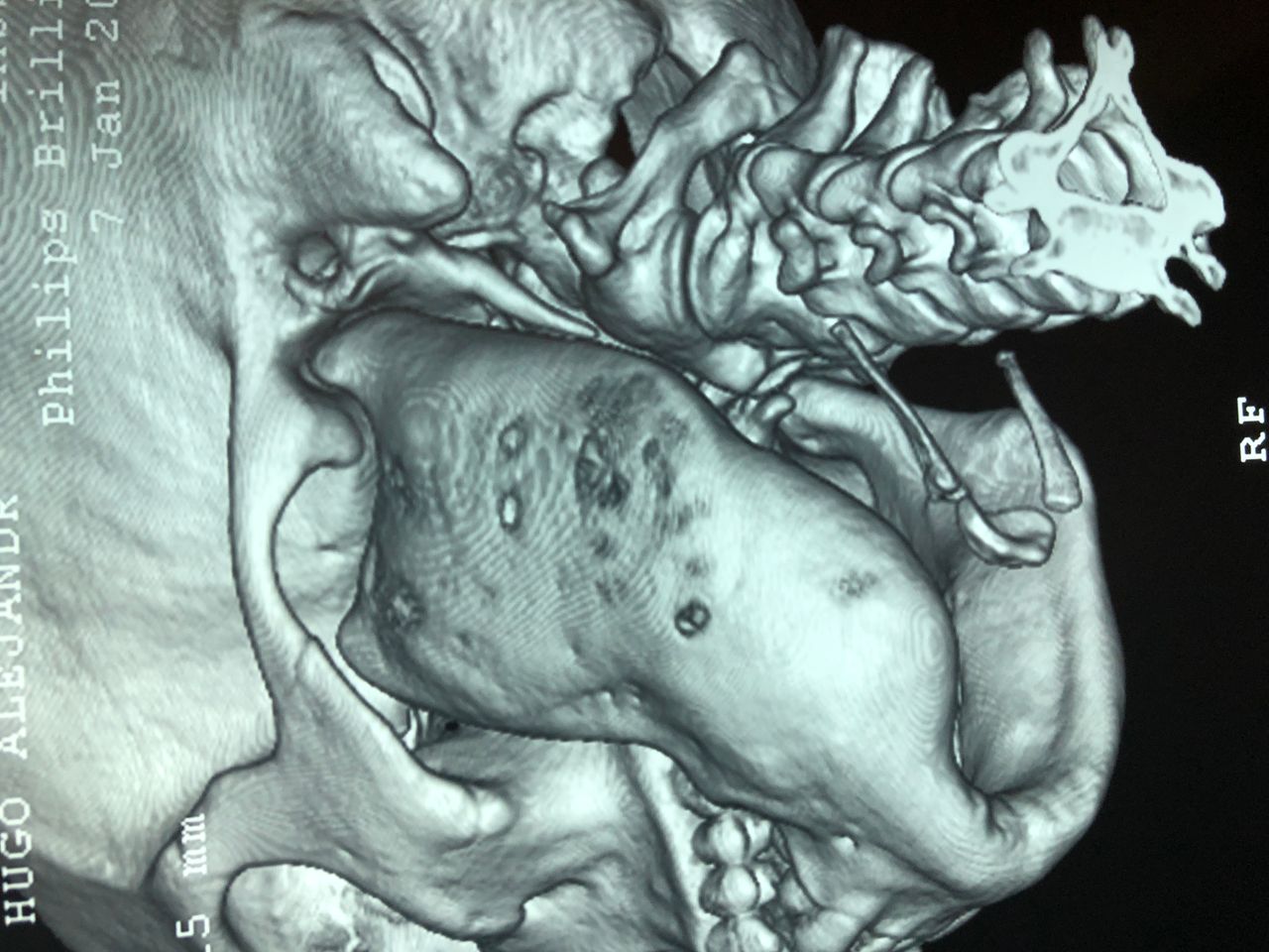 Luis Humberto Garcia Cabrera-8