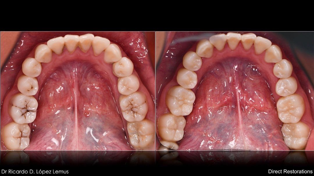 Ricardo López Lemus-69