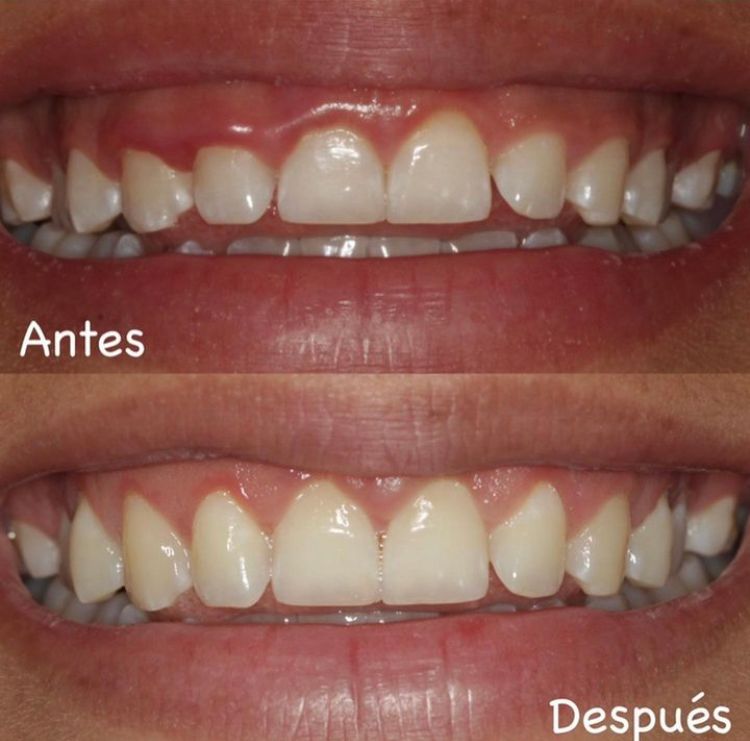 Agustin Salamanca Tapia-17