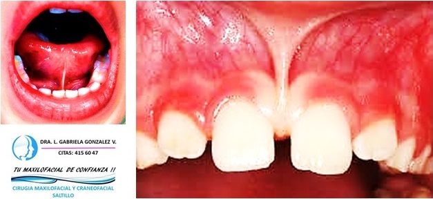 Laura Gabriela González Valdéz-57